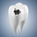 pixwords italiano CARIE